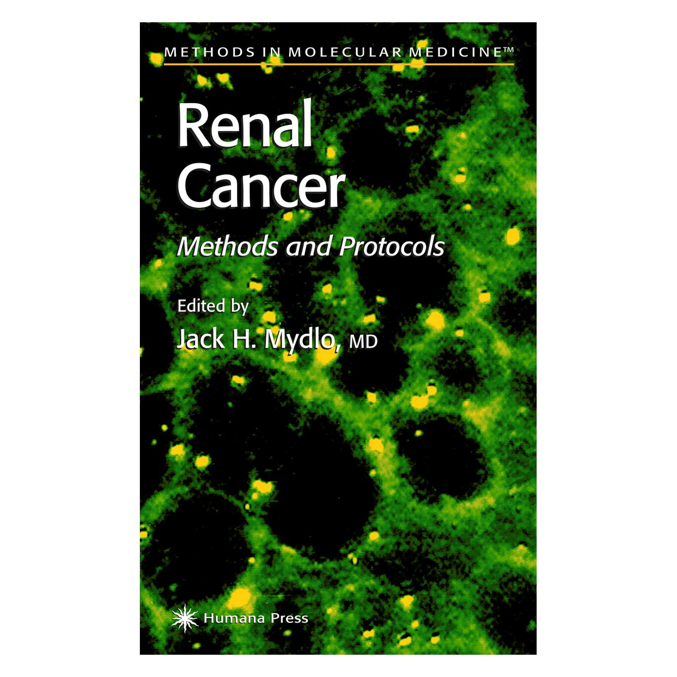 Springer Renal Cancer (Englisch, Softcover, Jack H. Mydlo) (55382621)
