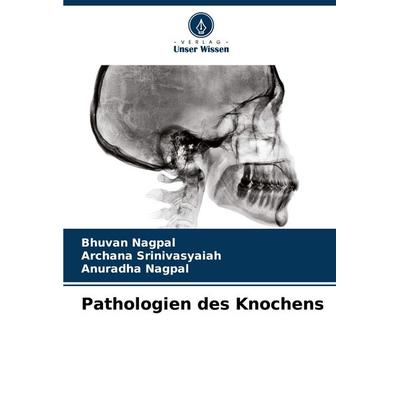 Pathologien des Knochens, Taschenbuch von Bhuvan Nagpal,Archana Srinivasyaiah,Anuradha Nagpal, Verlag Unser Wissen, 978-620-8-52888-1