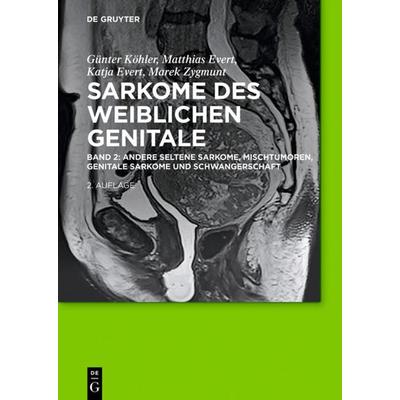 Andere seltene Sarkome, Mischtumoren, genitale Sarkome und Schwangerschaft, Gebundene Ausgabe von Günter Köhler,Matthias Evert,Katja Evert,Marek