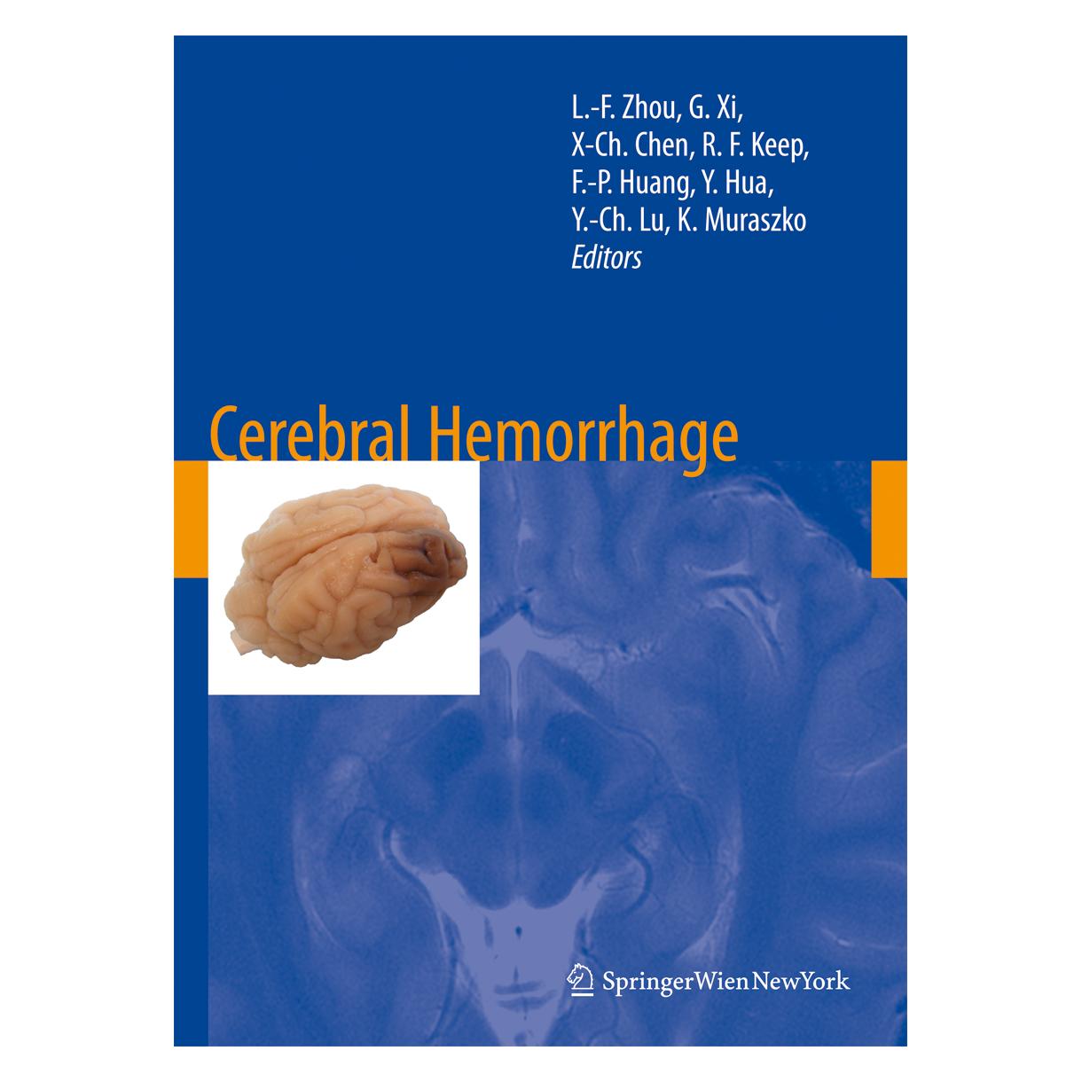 Springer Cerebral Hemorrhage (Englisch, Softcover, Feng-Ping Huang, Guohua Xi, Karin Muraszko, Liang-Fu Zhou, Richard F. Keep, Xian-Cheng Chen, Ya Hua, Yi-Cheng Lu) (55389069)