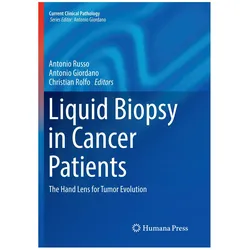 Liquid Biopsy in Cancer Patients, Fachbücher von Christian Rolfo, Antonio Russo, Antonio Giordano