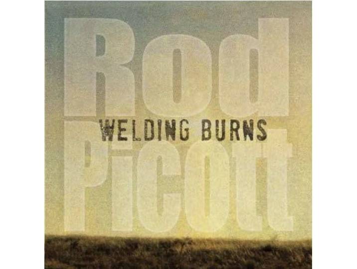 Welding Burns