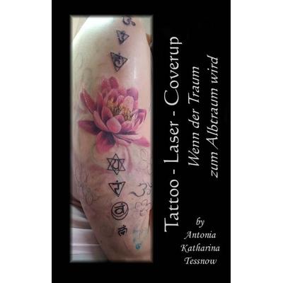 Tattoo - Laser - Cover Up, Taschenbuch von Antonia Katharina Tessnow, Twentysix, 978-3-7407-3433-6