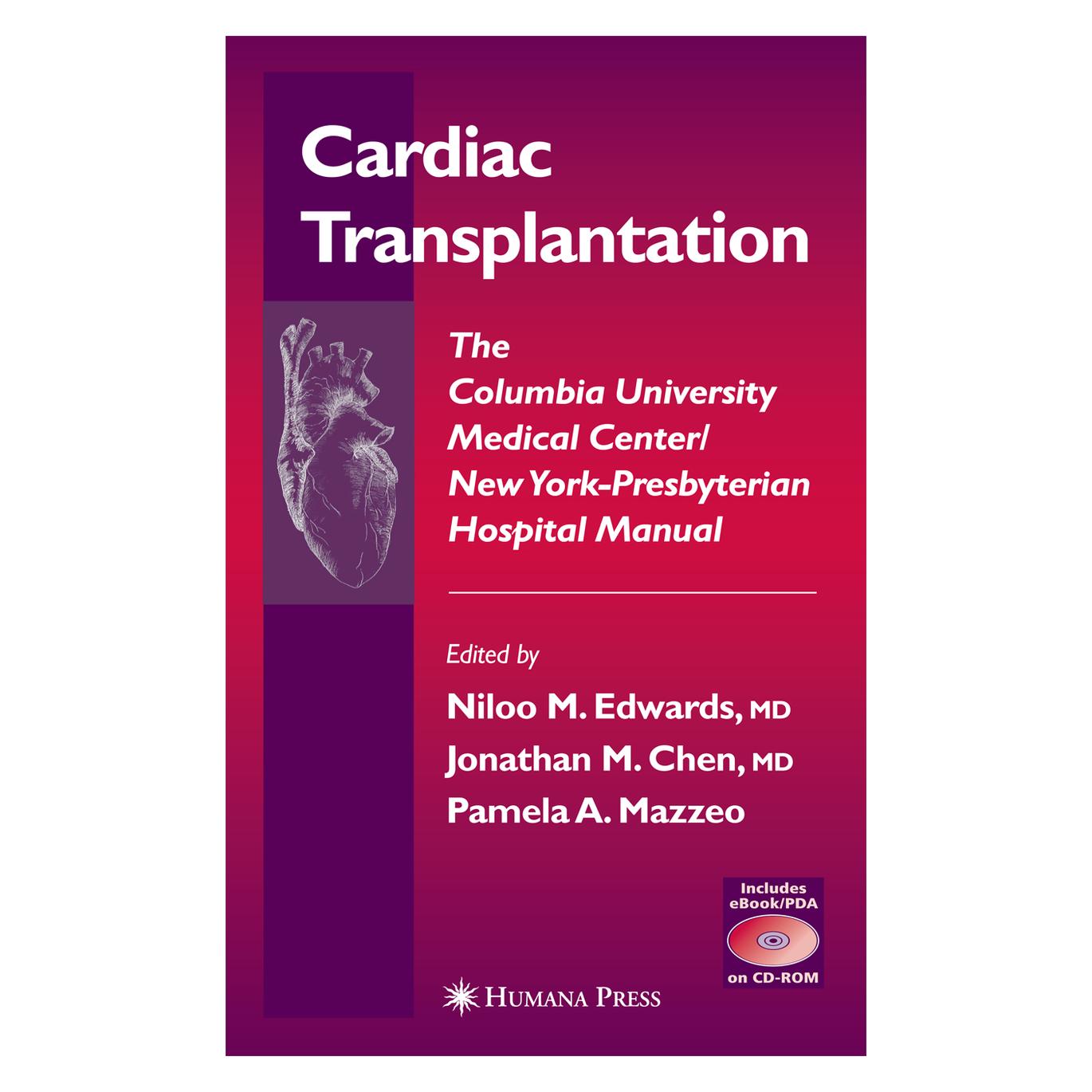 Springer Cardiac Transplantation (Englisch, Softcover, A Mazzeo, Jonathan, Jonathan M. Chen, M Chen, Niloo M. Edwards, Pamela, Pamela A. Mazzeo) (55538813)