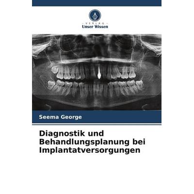 Diagnostik und Behandlungsplanung bei Implantatversorgungen, Taschenbuch von Seema George, Verlag Unser Wissen, 978-620-8-56268-7