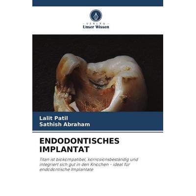 ENDODONTISCHES IMPLANTAT, Taschenbuch von Lalit Patil,Sathish Abraham, Verlag Unser Wissen, 978-620-9-85353-1