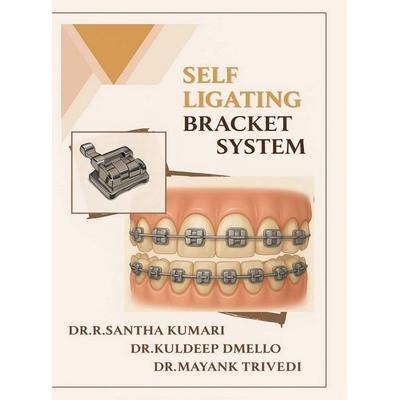 Self Ligating Bracket System, Gebundene Ausgabe von R. Santha Kumari, Notion Press Media Pvt. ltd