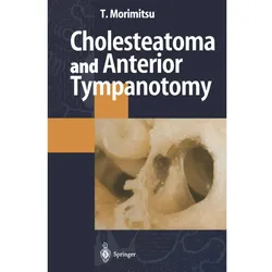 Cholesteatoma and Anterior Tympanotomy, Fachbücher von Tamotsu Morimitsu