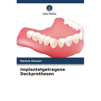 Implantatgetragene Deckprothesen, Taschenbuch von Namra Kausar, Verlag Unser Wissen, 978-620-6-24308-3