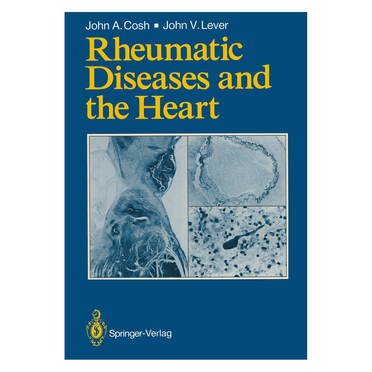 Springer Rheumatic Diseases and the Heart (Englisch, Softcover, John A. Cosh, John V Lever) (55530315)