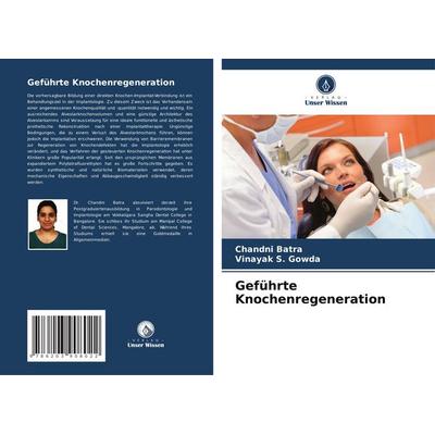 Batra, C: Geführte Knochenregeneration, Taschenbuch von Chandni Batra,Vinayak S. Gowda, Verlag Unser Wissen, 978-620-3-90802-2