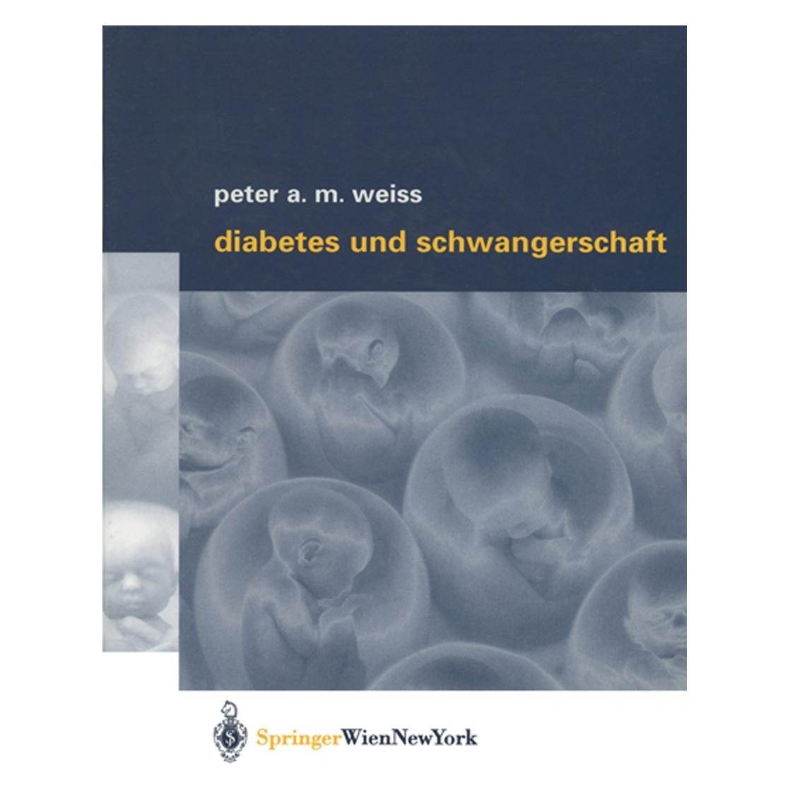 Springer Diabetes und Schwangerschaft (Deutsch, Softcover, Peter A.M. Weiss) (55530320)