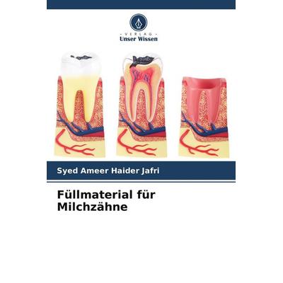 Füllmaterial für Milchzähne, Taschenbuch von Syed Ameer Haider Jafri, Verlag Unser Wissen, 978-620-9-91870-4