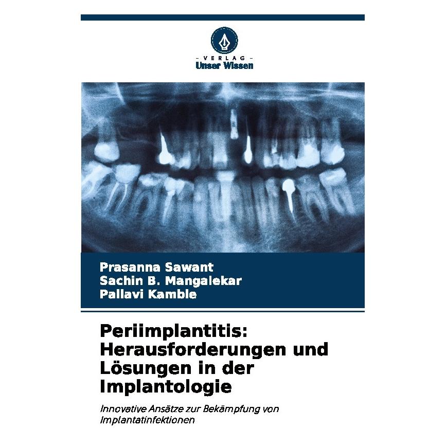 Bod Periimplantitis: Herausforderungen und Lösungen in der Implantologie (Deutsch, Softcover, Pallavi Kamble, Prasanna Sawant, SACHIN B MANGALEKAR) (57201361)