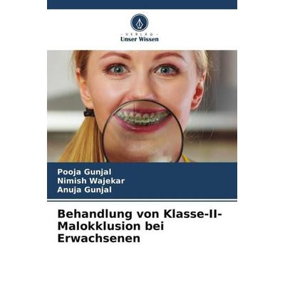 Behandlung von Klasse-II-Malokklusion bei Erwachsenen, Taschenbuch von Pooja Gunjal,Nimish Wajekar,Anuja Gunjal, Verlag Unser Wissen,