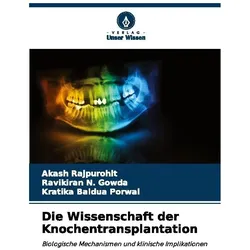 Die Wissenschaft der Knochentransplantation, Fachbücher von Ravikiran N. Gowda, Kratika Baldua Porwal, Akash Rajpurohit