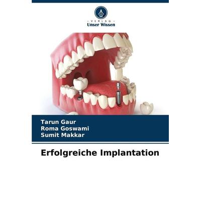 Erfolgreiche Implantation, Taschenbuch von Tarun Gaur,Roma Goswami,Sumit Makkar, Verlag Unser Wissen, 978-620-2-67386-0