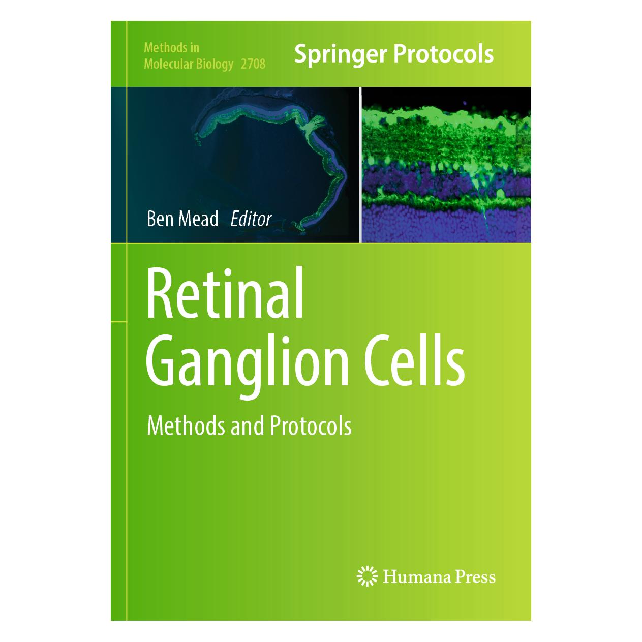 Springer Retinal Ganglion Cells (Englisch, Softcover) (57098359)
