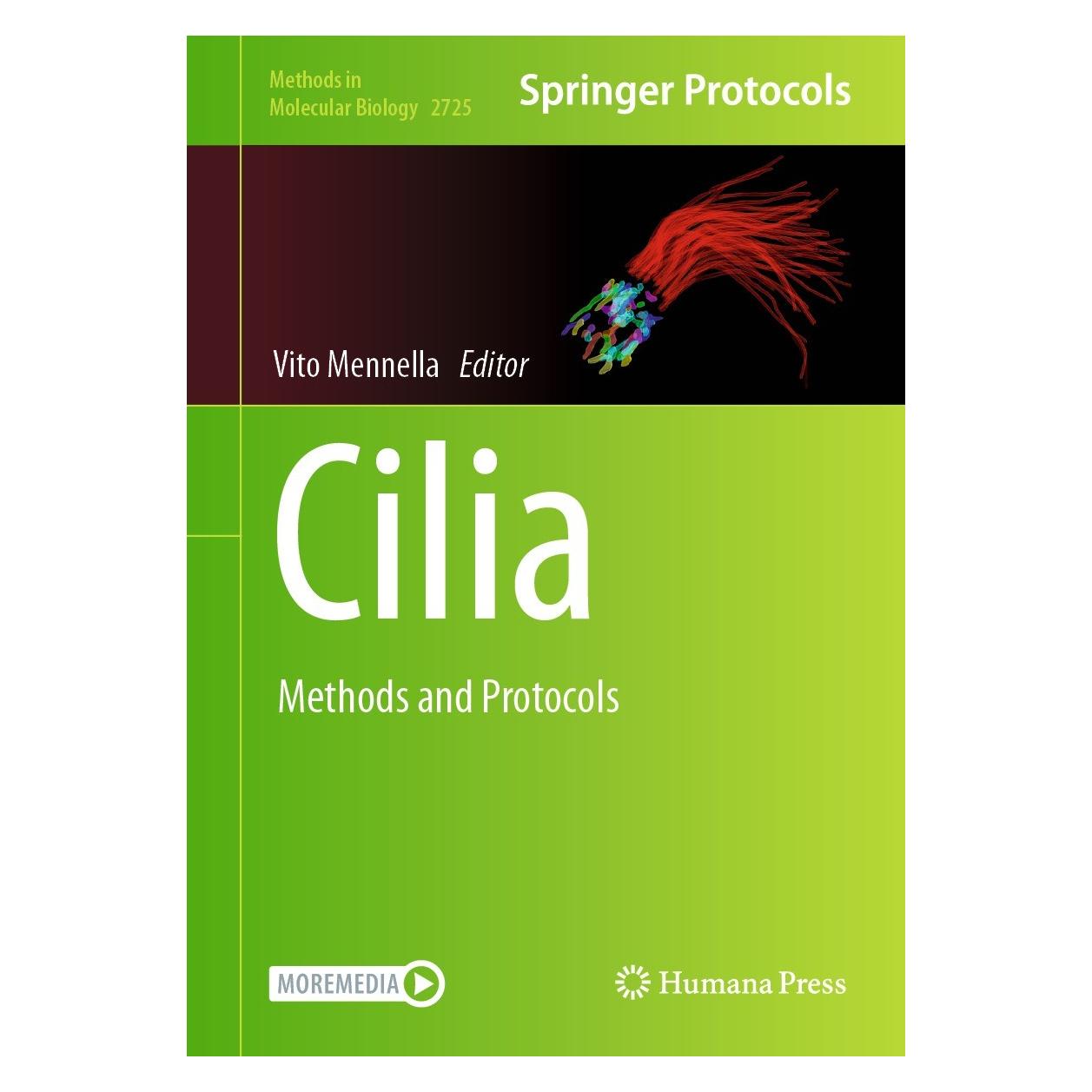 Springer Cilia (Englisch, Hardcover, Vito Mennella) (9781071635063)