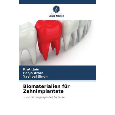 Biomaterialien für Zahnimplantate, Taschenbuch von Krati Jain,Pooja Arora,Yashpal Singh, Verlag Unser Wissen
