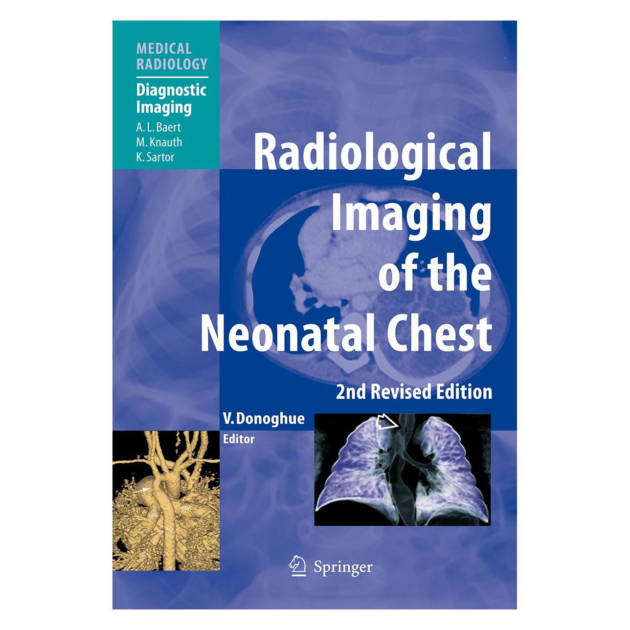 Springer Radiological Imaging of the Neonatal Chest (Englisch, Softcover, Veronica B. Donoghue) (55376109)