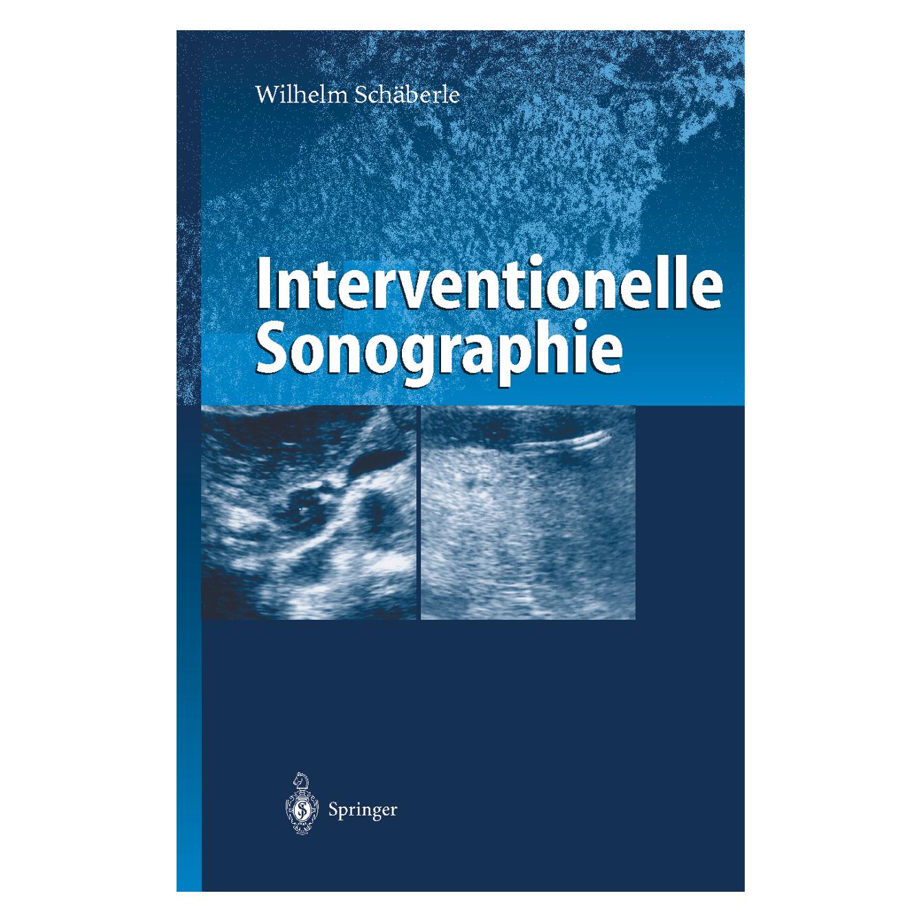 Springer Interventionelle Sonographie (Deutsch, Softcover, Wilhelm Schäberle) (55509587)