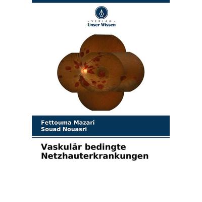 Vaskulär bedingte Netzhauterkrankungen, Taschenbuch von Fettouma Mazari,Souad Nouasri, Verlag Unser Wissen, 978-620-7-51377-2