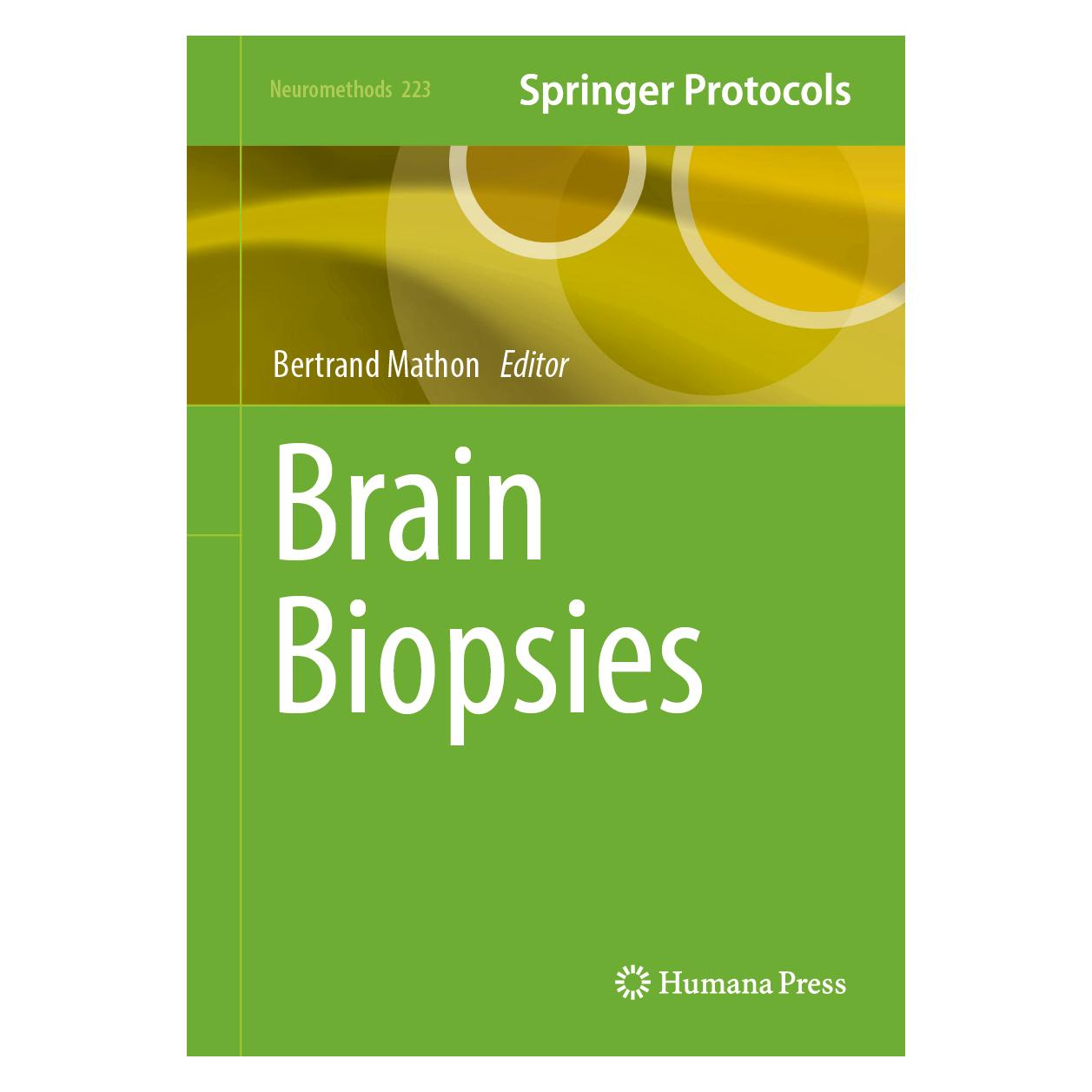 Springer Brain Biopsies (Englisch, Hardcover, Bertrand Mathon) (61626789)