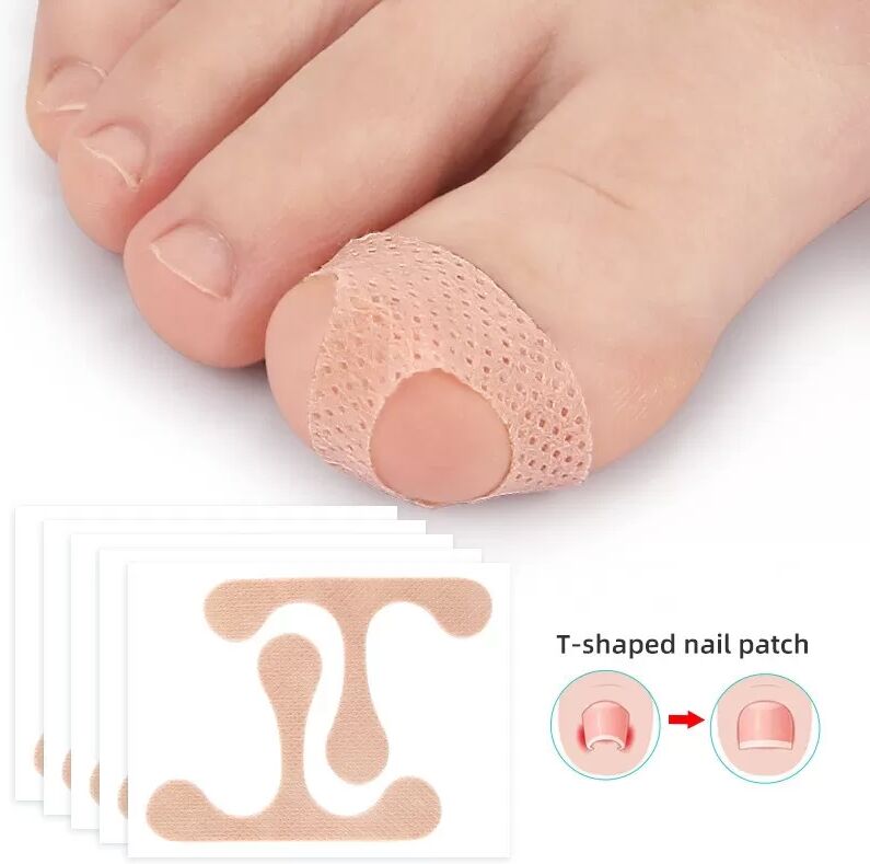 INF Patchs correcteurs d'orteils, bandage de correction des ongles incarnés
