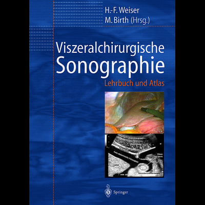 Viszeralchirurgische Sonographie, Taschenbuch von , Springer Berlin, 978-3-642-62958-7