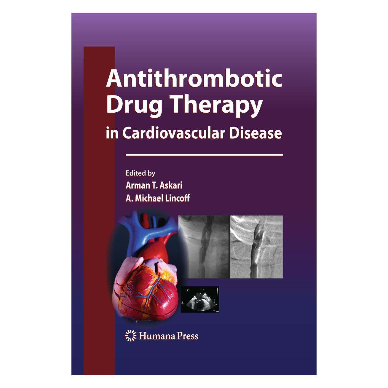 Springer Antithrombotic Drug Therapy in Cardiovascular Disease (Englisch, Softcover, A. Michael Lincoff, Arman T. Askari) (55575087)