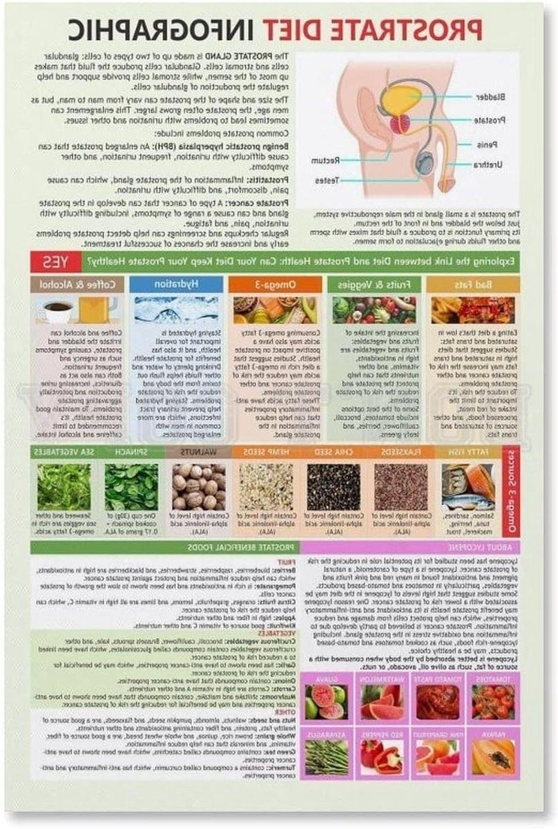 Educatieve Gezondheids Poster Infographic op Canvas, 40 x 60 cm, Omlijst