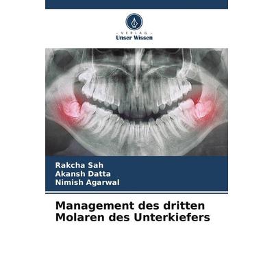Management des dritten Molaren des Unterkiefers, Taschenbuch von Rakcha Sah,Akansh Datta,Nimish Agarwal, Verlag Unser Wissen, 978-3-639-79264-5