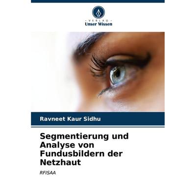 Segmentierung und Analyse von Fundusbildern der Netzhaut, Taschenbuch von Ravneet Kaur Sidhu, Verlag Unser Wissen, 978-620-6-66445-1