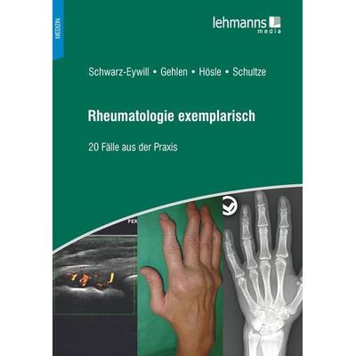 Rheumatologie exemplarisch, Taschenbuch von Michael Schwarz-Eywill,Martin Gehlen,Rosmarie Hösle,Mareen Schultze, Lehmanns Media, 978-3-96543-062-4