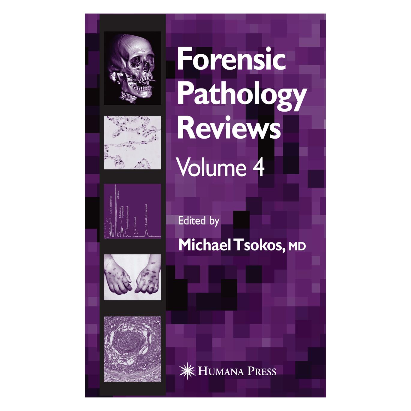 Springer Forensic Pathology Reviews Vol 4 (Englisch, Softcover) (55381984)