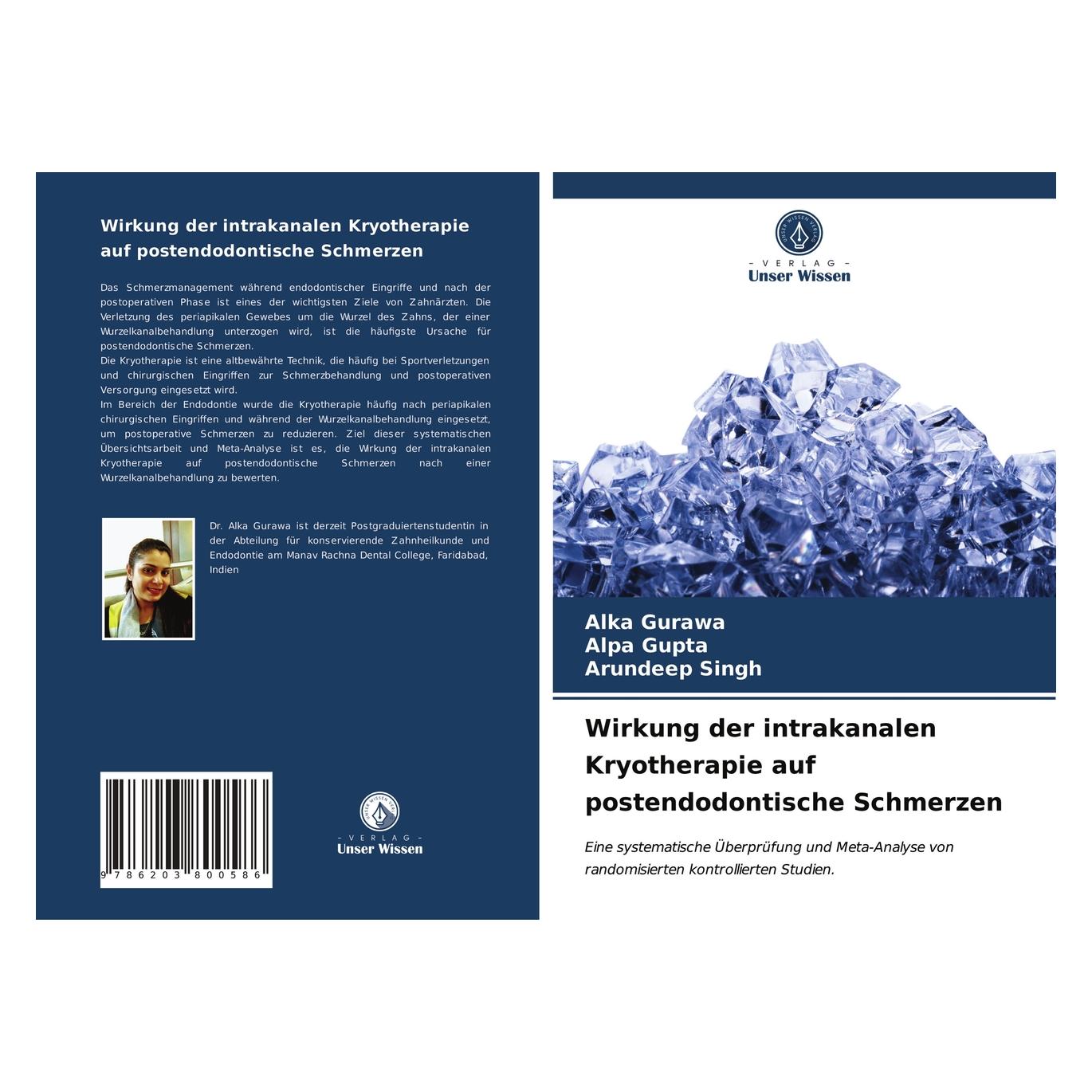 Unser Wissen Wirkung der intrakanalen Kryotherapie auf postendodontische Schmerzen (56199408)