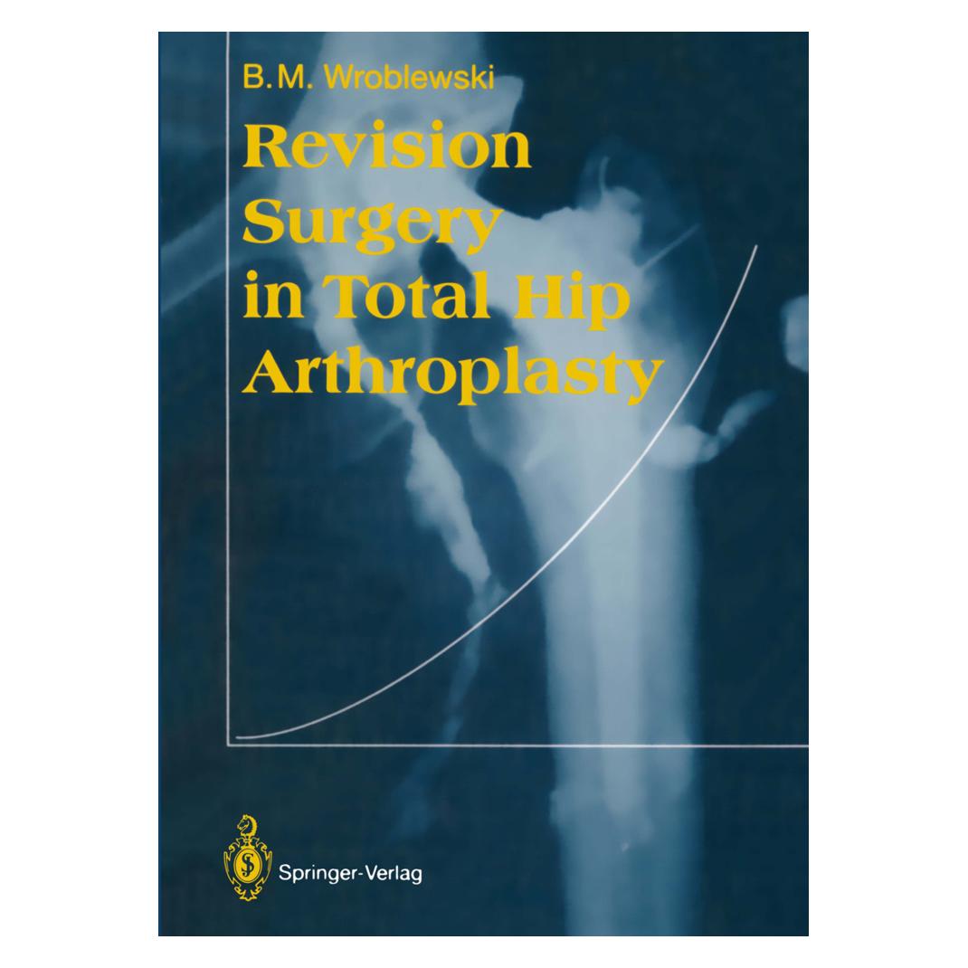 Springer Revision Surgery in Total Hip Arthroplasty (Englisch, Softcover, Boguslaw M. Wroblewski) (55533563)