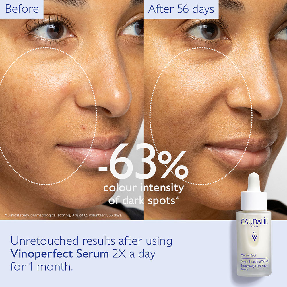 Caudalie Vinoperfect sérum resplandor antimanchas 30 ml