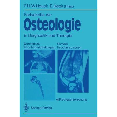 Fortschritte der Osteologie in Diagnostik und Therapie, Taschenbuch von , Springer Berlin, 978-3-540-50190-9