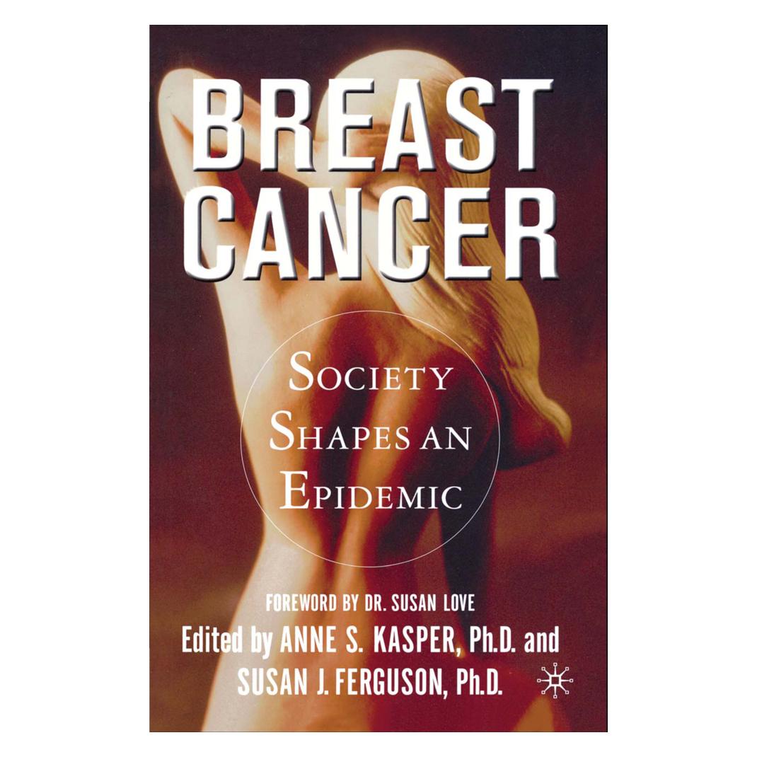 Springer Breast Cancer (Englisch, Softcover, NA NA) (55613399)