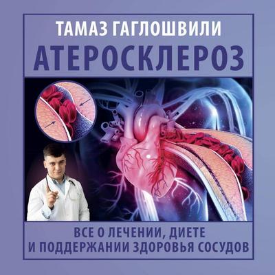 Ateroskleroz. Vse o lechenii, diete i podderzhanii zdorovya sosudov - Tamaz Hagloshvili, Audio, 9785171783754