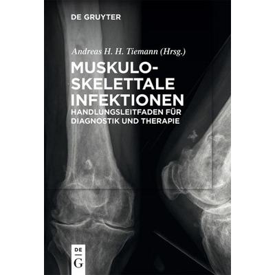 Muskuloskelettale Infektionen, Taschenbuch von , De Gruyter, 978-3-11-047315-5