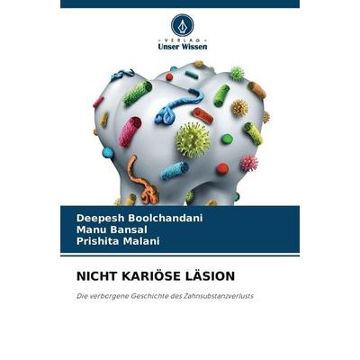NICHT KARIÖSE LÄSION, Taschenbuch von Deepesh Boolchandani,Manu Bansal,Prishita Malani, Verlag Unser Wissen, 978-620-9-91755-4