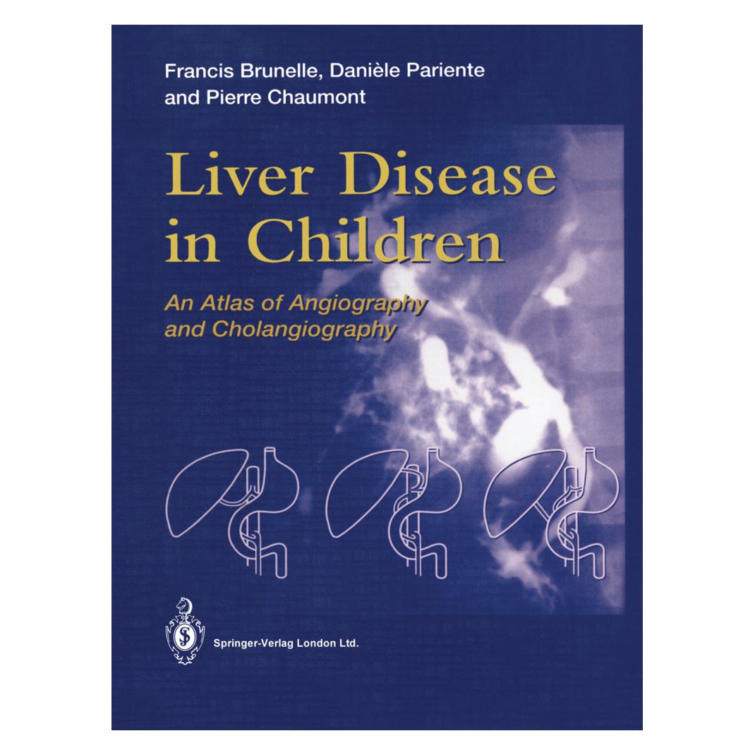 Springer Liver Disease in Children (Englisch, Softcover, Daniele Pariente, Francis Brunelle, Pierre Chaumont) (55538468)