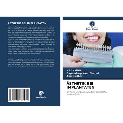 Ästhetik bei Implantaten, Taschenbuch von Nikita Dixit,Gagandeep kaur Chahal,ANU Girdhar, Verlag Unser Wissen, 978-620-8-71547-2