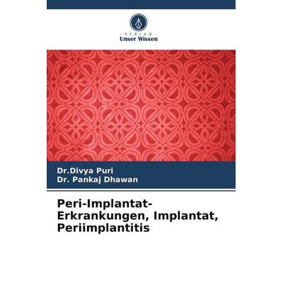 Peri-Implantat-Erkrankungen, Implantat, Periimplantitis, Taschenbuch von Divya Puri,Pankaj Dhawan, Verlag Unser Wissen, 978-620-5-08477-9