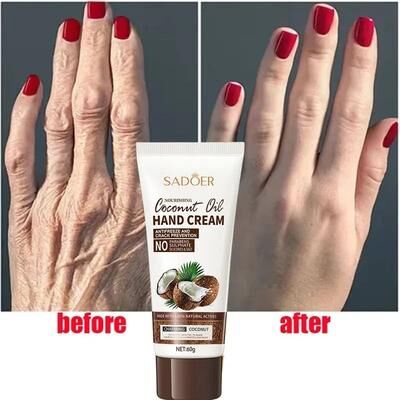 Uplift Essentials Anti Wrinkle Coconut Oil Hand Cream Intensive Anti Crack & Repair Serum Anti Wrinkle Coconut Oil Hand Cream Intensive Anti Crack & Repair Serum