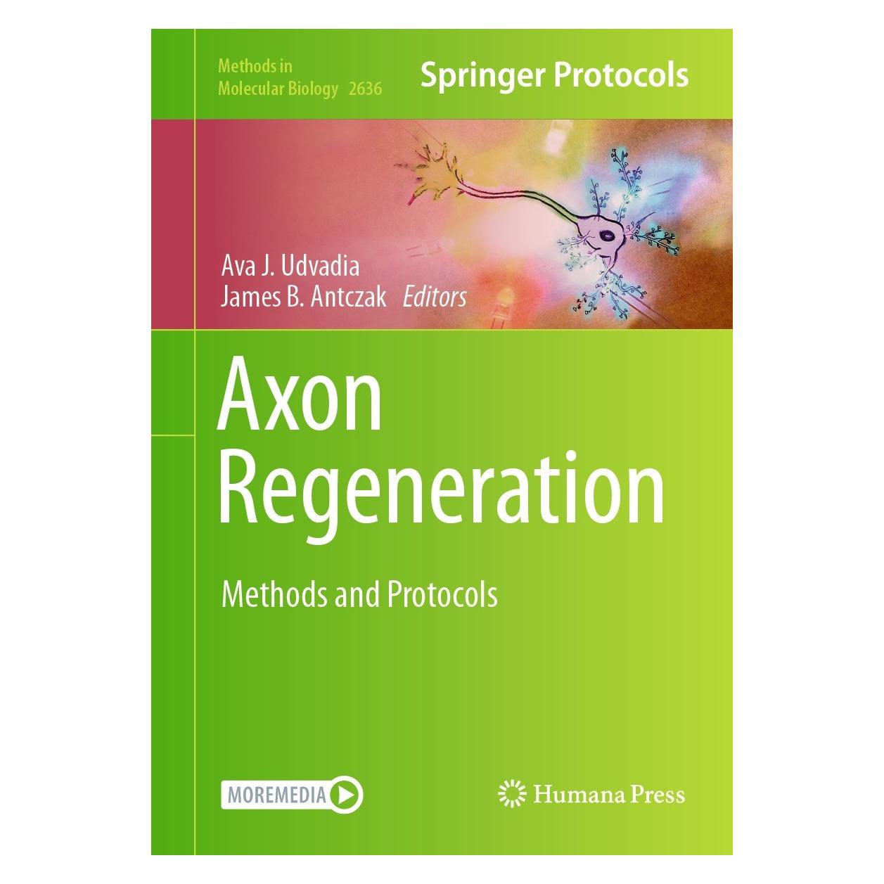 Springer Axon Regeneration (Englisch, Hardcover, Ava J. Udvadia, James B. Antczak) (9781071630112)