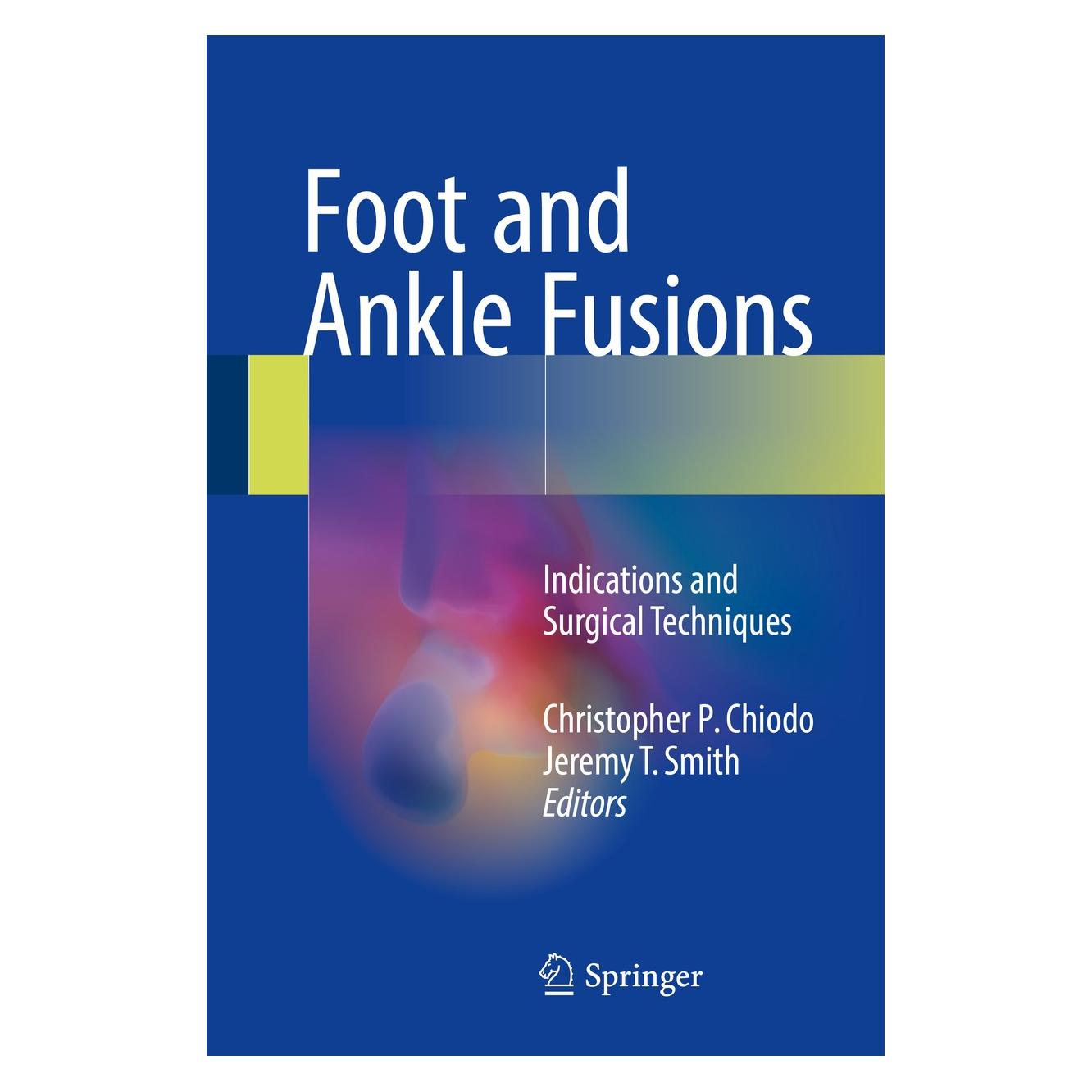 Springer Foot and Ankle Fusions (Englisch, Hardcover, Christopher P. Chiodo, Jeremy T. Smith) (9783319430164)